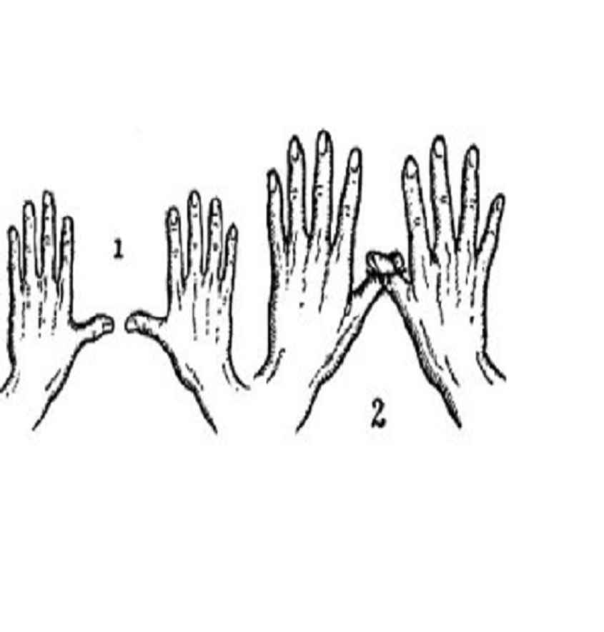 Manufacturer, Exporter, Importer, Supplier, Wholesaler, Retailer, Trader of Thumb Tie in New Delhi, Delhi, India.
